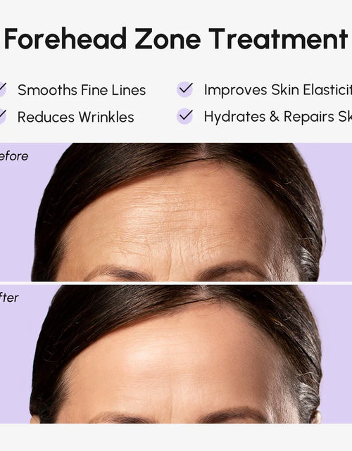 Load image into Gallery viewer, Anti-Wrinkle Forehead Patches
